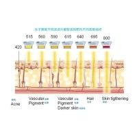 五大光子嫩膚技術（IPL、DPL、OPT、APT、BBL）及濾光片區別
